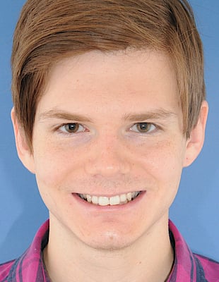 Tiefbiss vorher