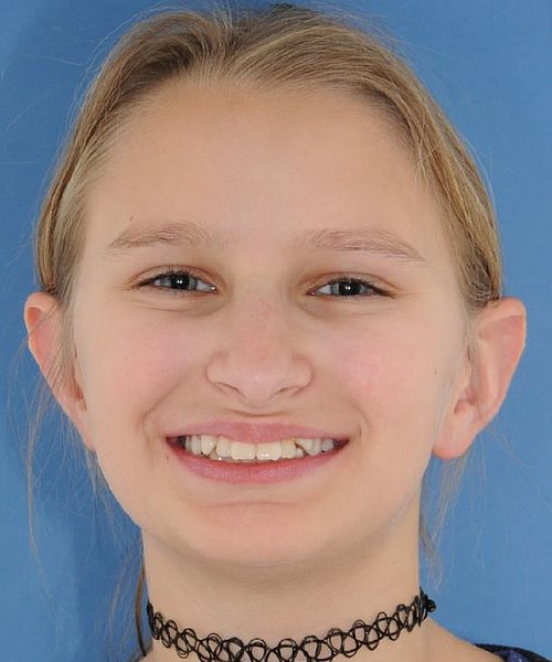 Barbara vorher