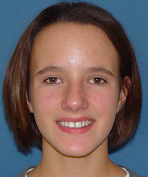 Carla vorher