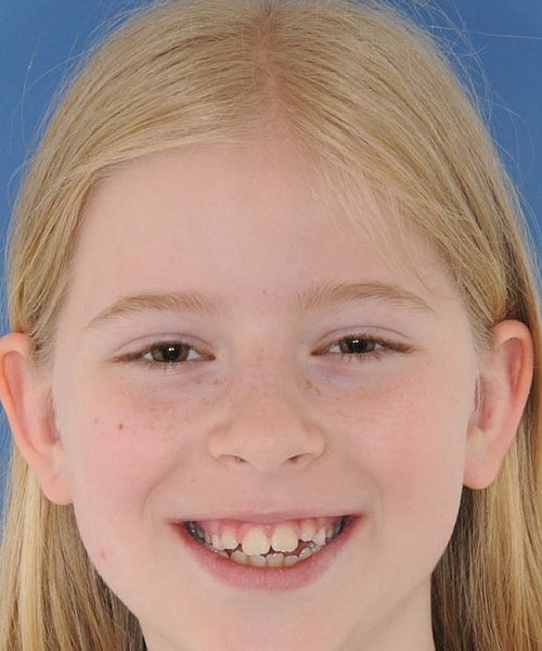 Clara vorher