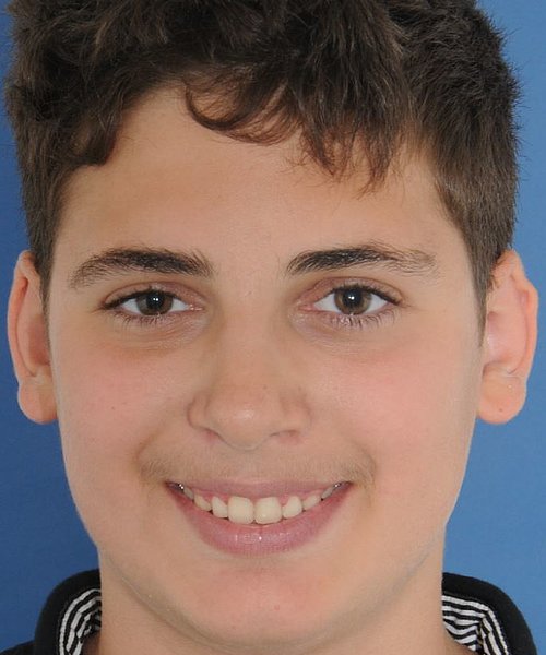 Florian nachher
