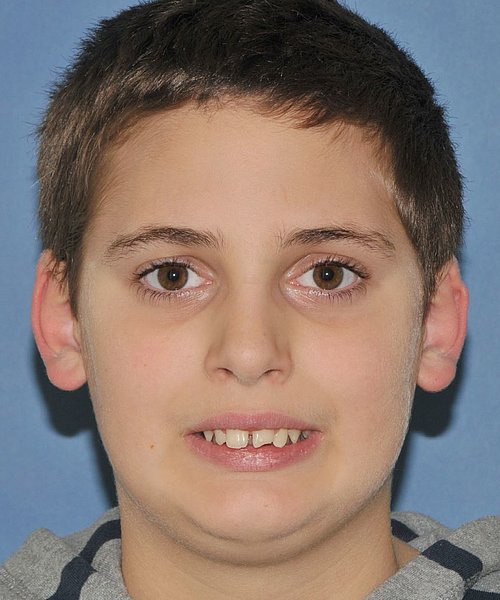 Florian vorher