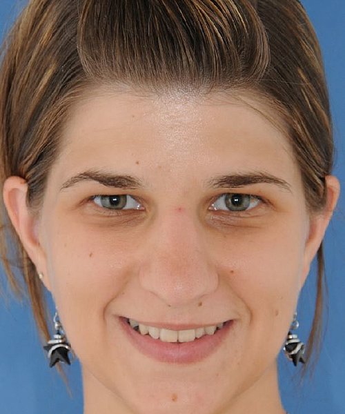 Karin nachher