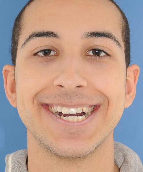 Michael vorher