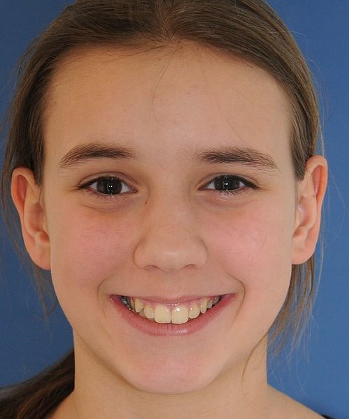 Nina vorher
