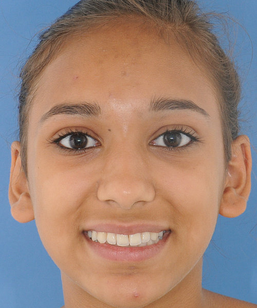 Raihana nachher