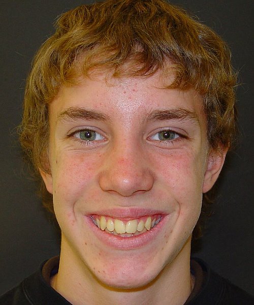 Sascha vorher